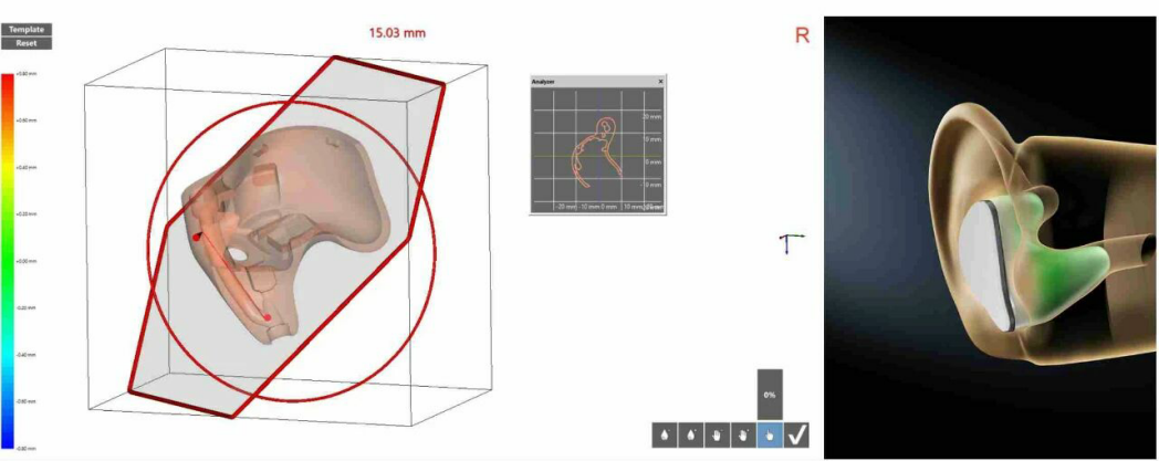 从频繁捡耳机到狂甩不掉听智慧定制蓝牙耳机如何终结佩戴尴尬(图2)