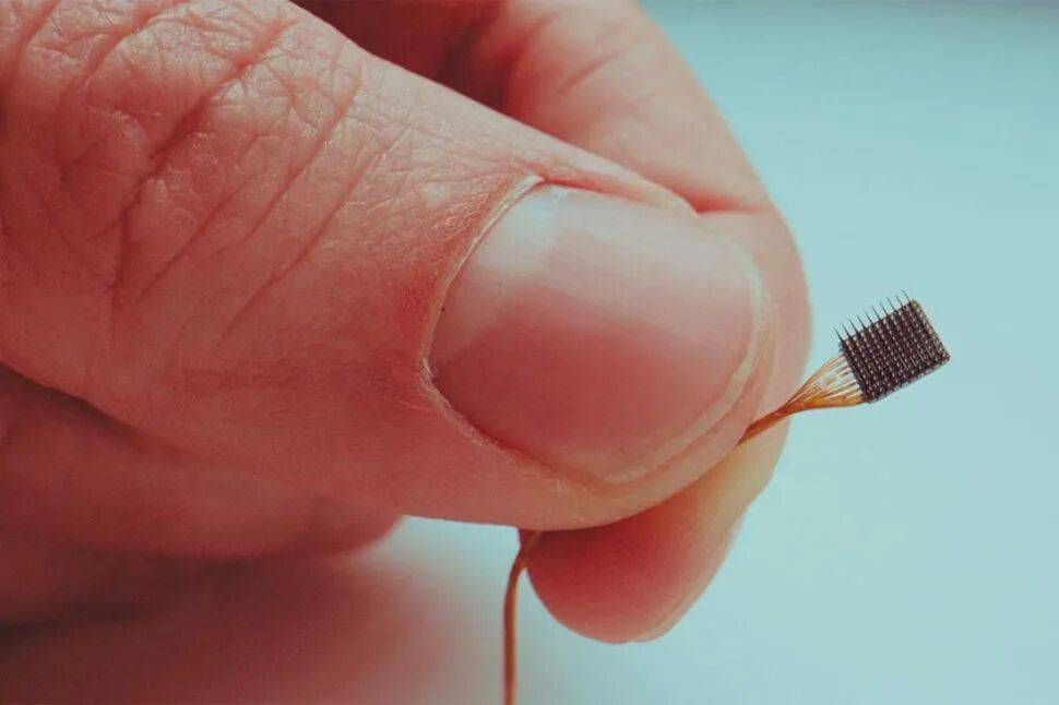 脑机接口最重要的10家公司！(图2)